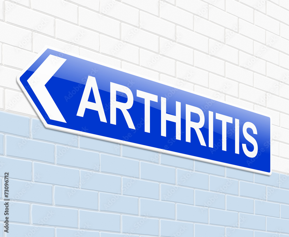 Arthritis concept. Arthritis concept.