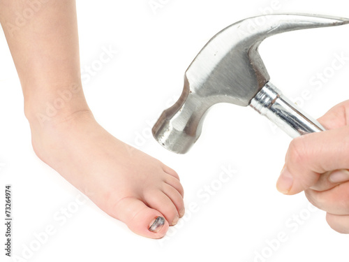 Someone holding a hammer over a child's foot with blue hallux na