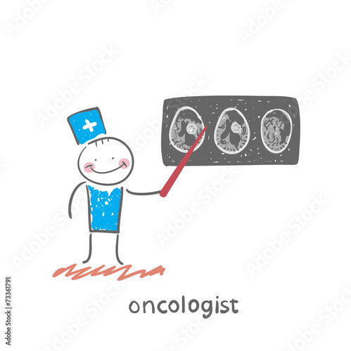oncologist shows the X-ray imaging