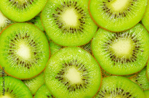 Kiwi Background