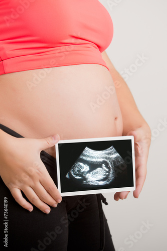 Woman Holding an UltraSound photo