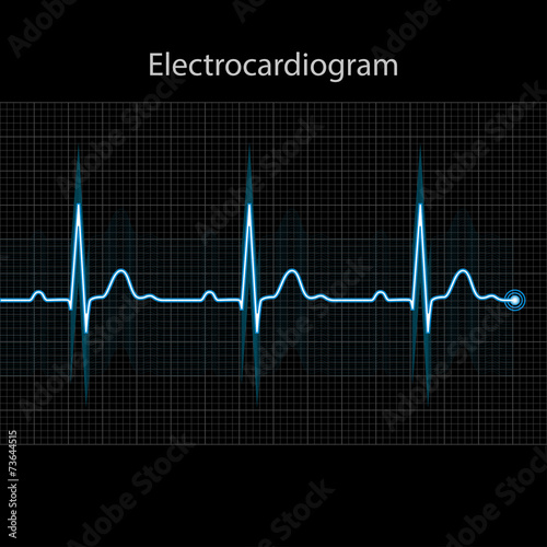 Electrocardiogram 2d illustration