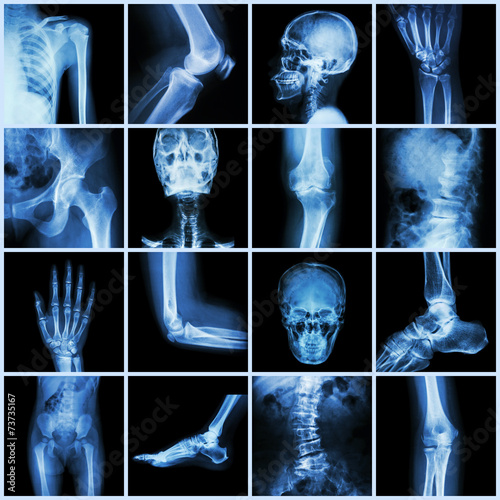 Collection human joint
