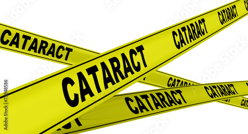Катаракта (cataract). Желтая оградительная лента