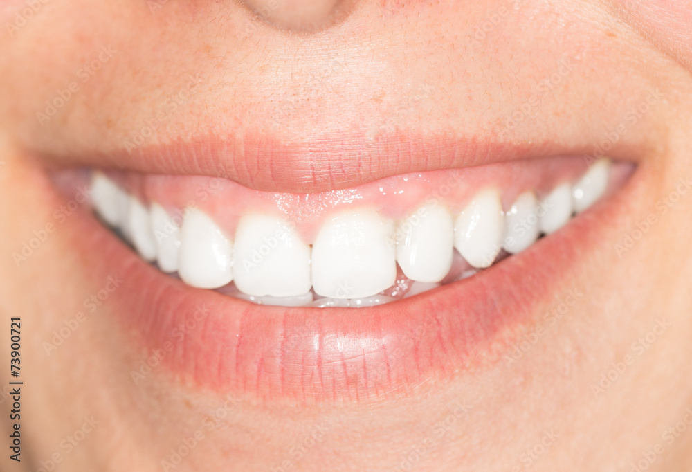 Fototapeta premium beautiful smile with white teeth