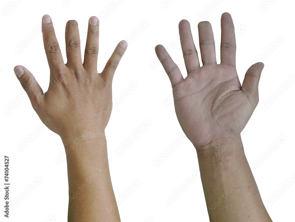 Asian man right hand injured while working on his middle finger. Asian man right hand injured while working on his middle finger.