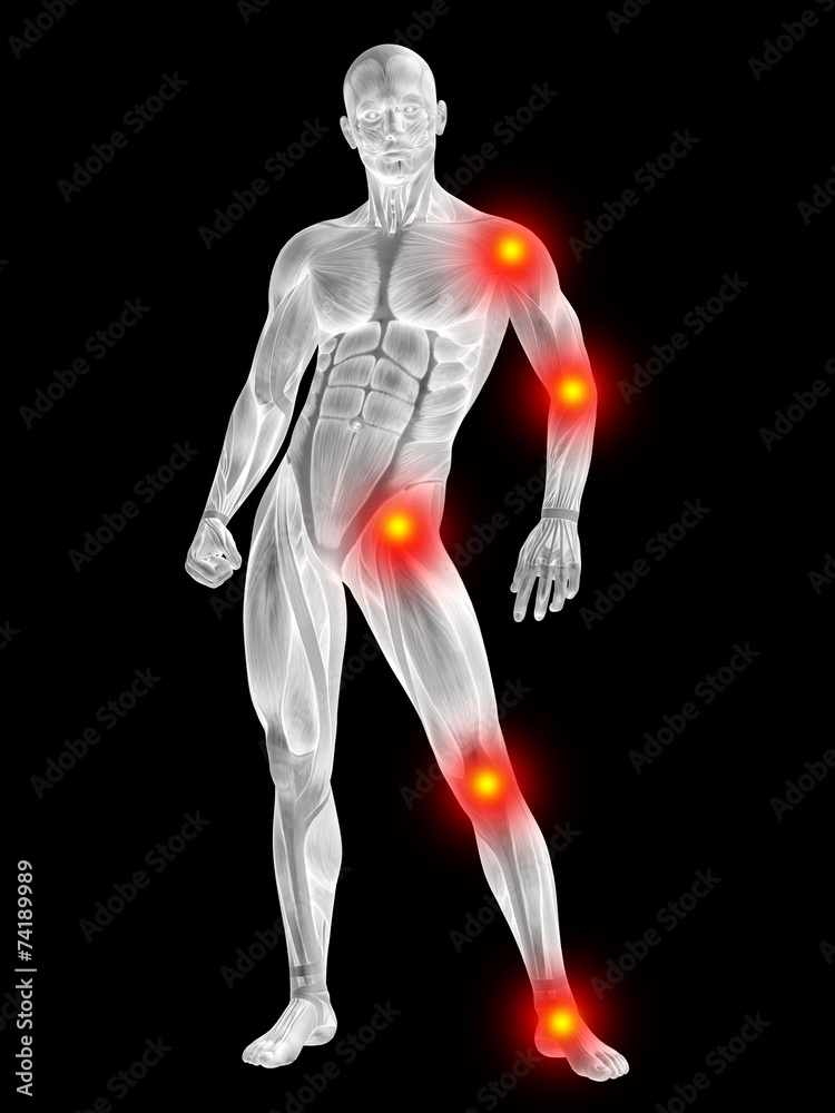 3D human man anatomy with articular pain