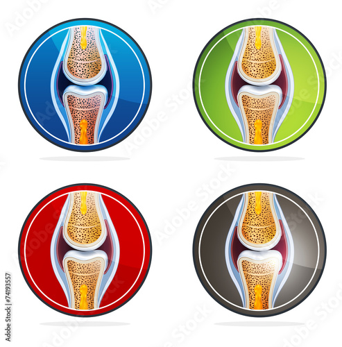Joint anatomy symbol set. Colorful illustrations