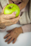 Rheumatoid arthritis hands and fruits