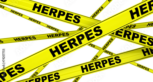 Герпес (herpes). Желтая оградительная лента