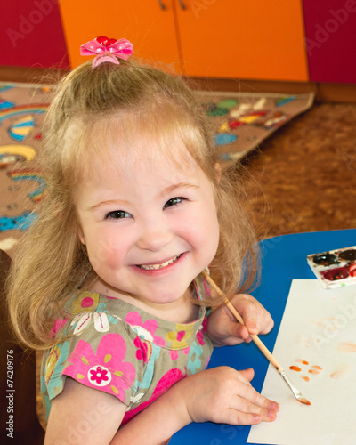 Girl,syndrome, down syndrome