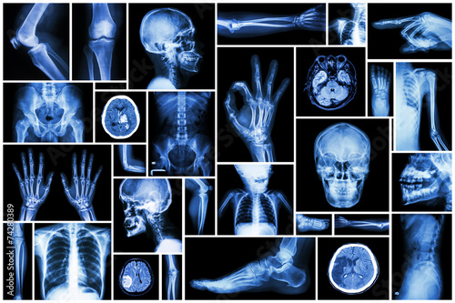 Collection X-ray multiple part of human