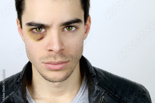 portrait of a handsome young man with a shiner photo