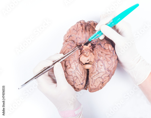 Εκτύπωση καμβά human brain dissection
