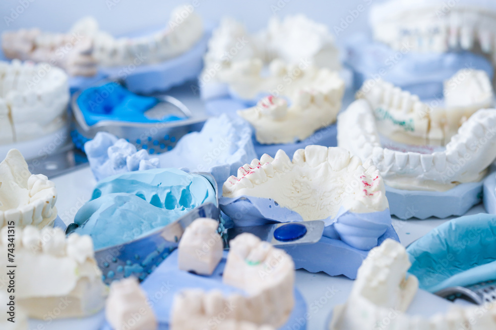 Dental plaster moulds and imprints
