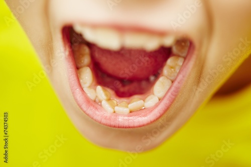 Teeth photo