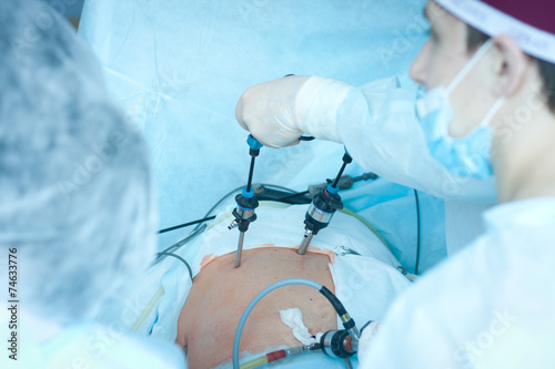 gallbladder removal