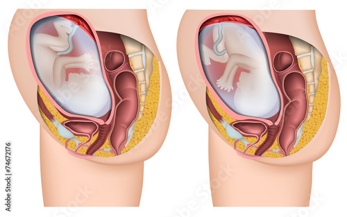 Lage des Kindes im Mutterleib, medical vector illustration