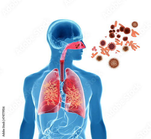 Pollen allergy / Hay fever/ Influenza infection