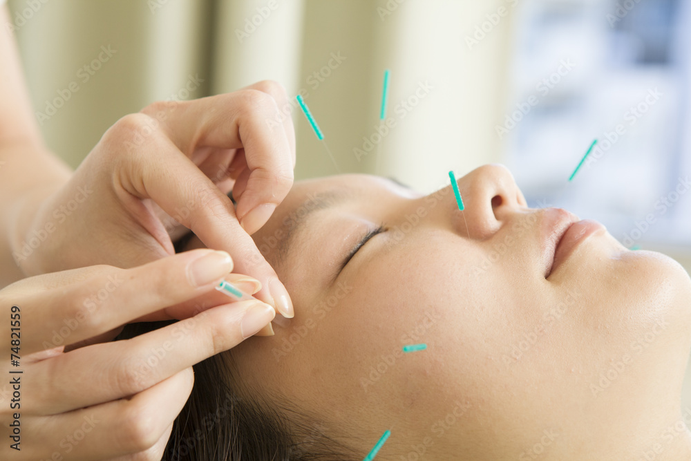 Naklejka premium Żeński akupunkturzysta, aby odnieść się do akupunktury w twarz