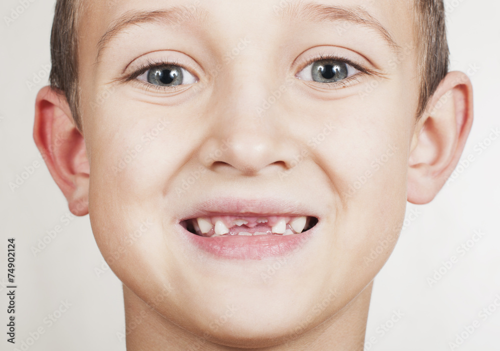 loss of primary teeth in children loss of primary teeth in children
