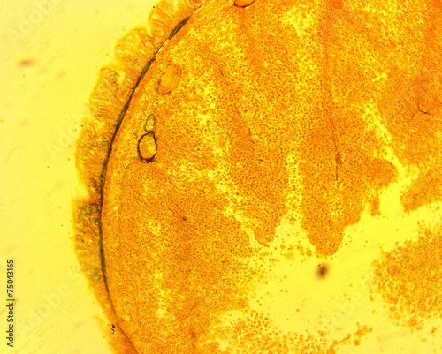 Nemertine worm (Lineus gesserensis) transverse slit slide plate photo