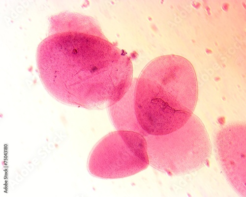 Opalina ranarum - permanent slide plate under high magnification