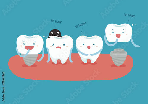 dental implant vector