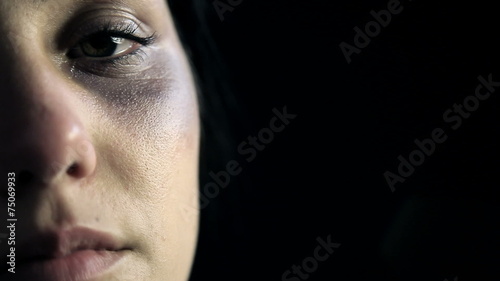 Woman with bruises after violence looking