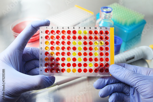 Scientists hands holding open well plate with samples