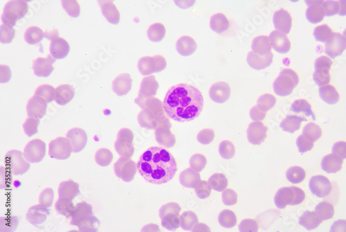 neutrophil on blood smear photo