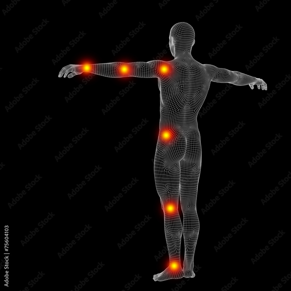 3D wireframe anatomy with pain 3D wireframe anatomy with pain