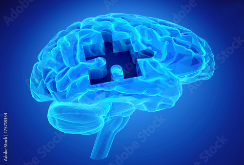 Dementia disease and a loss of brain function and memories