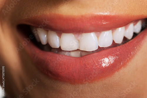 Close up on woman white teeth