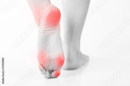 Female foot pain, Woman's problem © leszekglasner