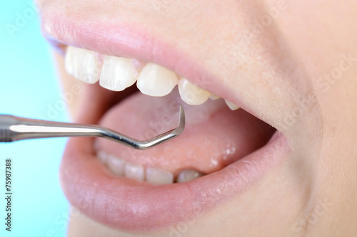 Zahnbehandlung durch Zahnarzt mit Haken