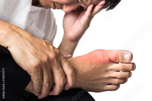 Man with painful and swollen right foot due to gout inflammation photo