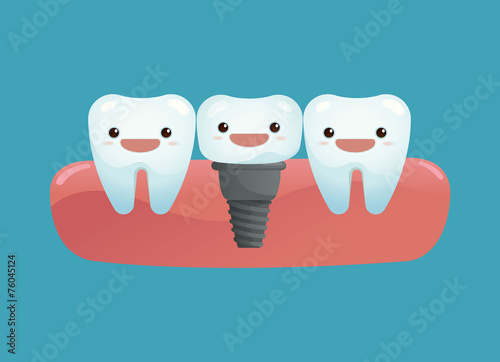 Tooth implant