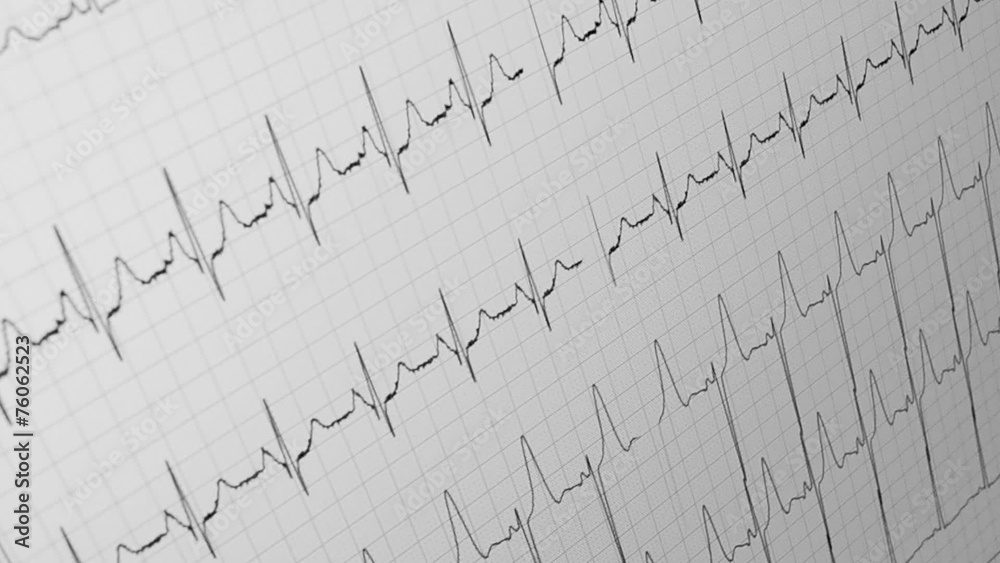 pulse, healthcare, cardiovascular diagram Stock Video Adobe Stock