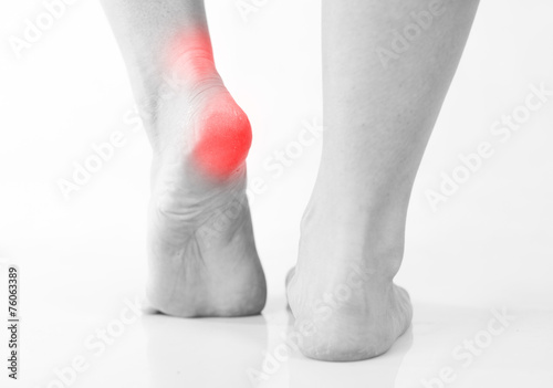 Woman's legs, heel and ankle pain