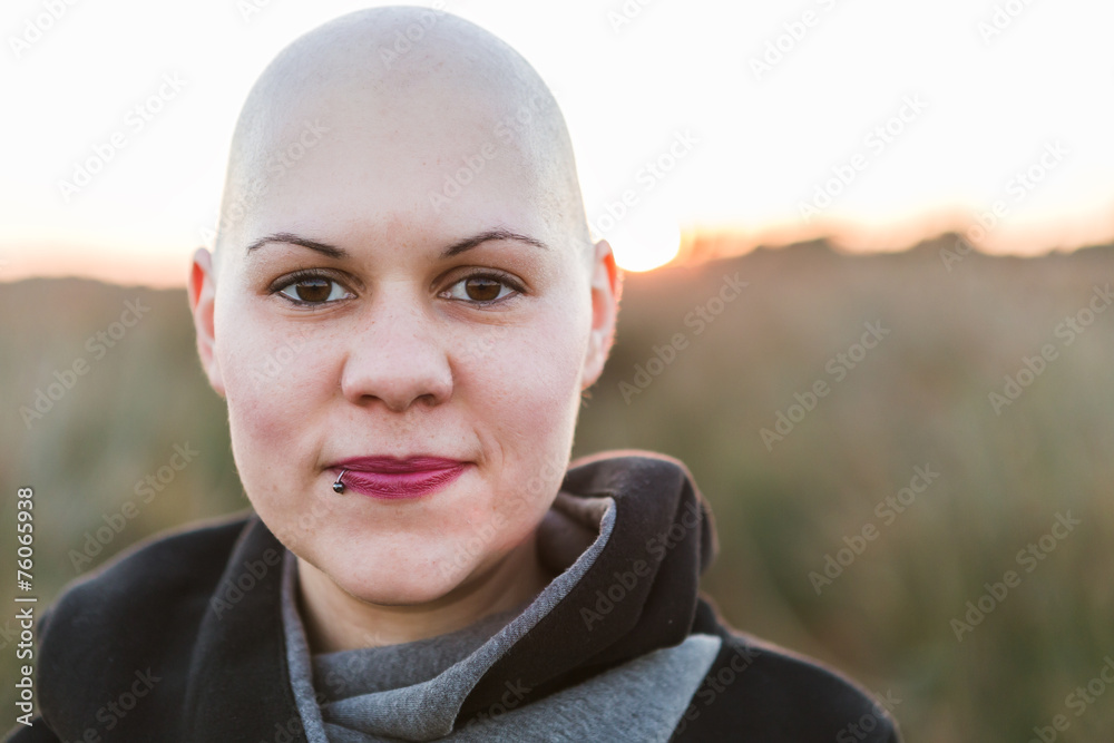 Real Female hairless fight against cancer outdoor Real Female hairless fight against cancer outdoor