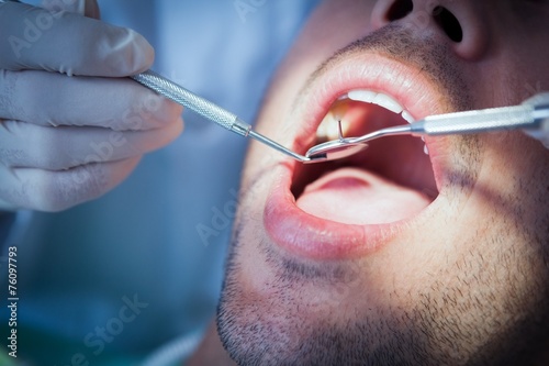 Close up of man having his teeth examined