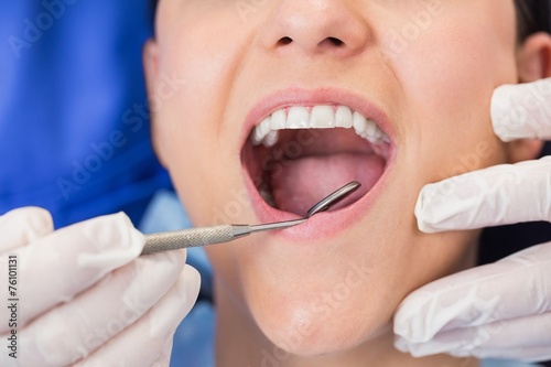 Dentist examining a patient with angle mirror
