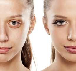 Comparison portrait of a woman without and with makeup