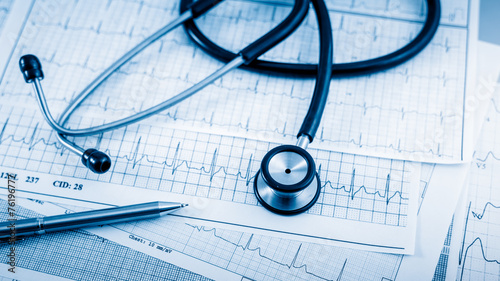 Stethoscope on cardiogram concept for heart care