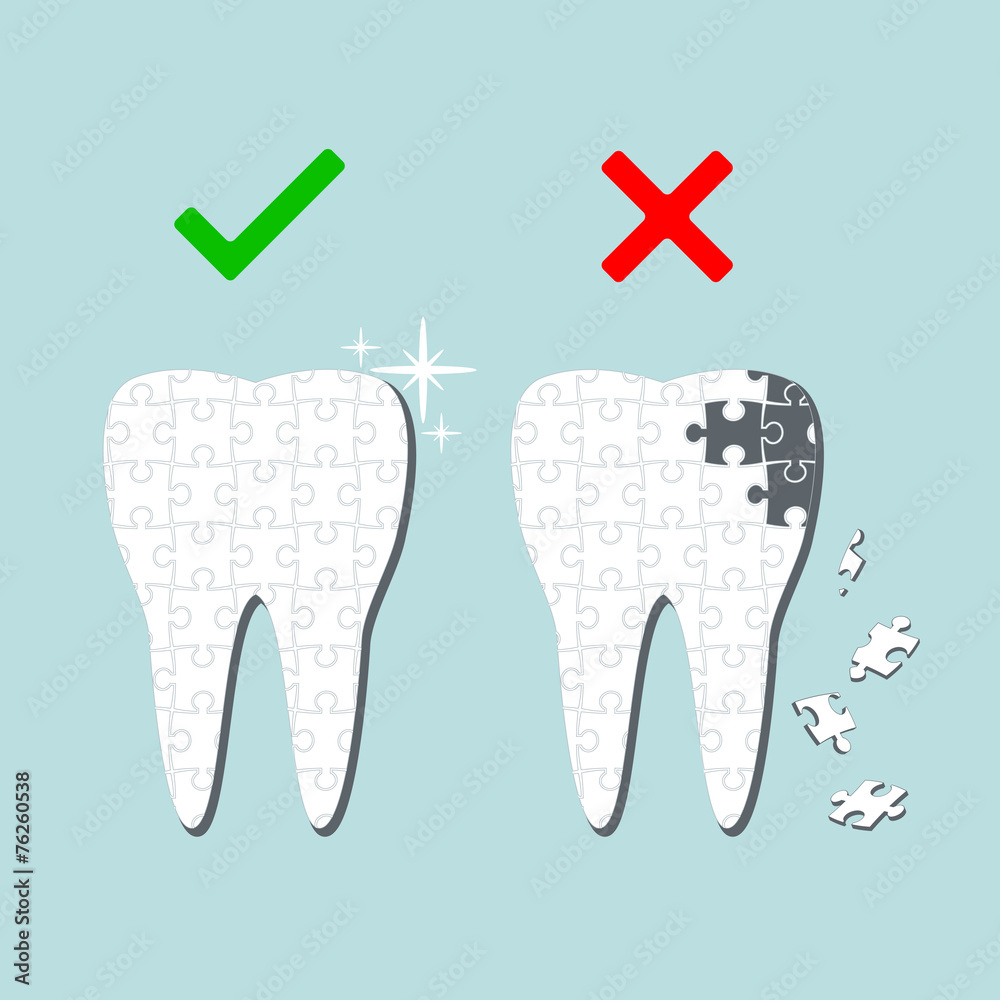 Sick and healthy tooth. Infographics. Sick and healthy tooth. Infographics.