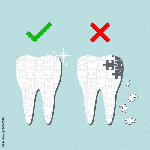 Sick and healthy tooth. Infographics.