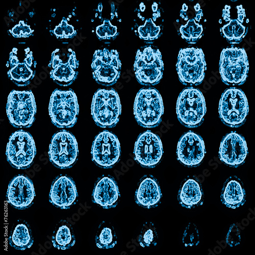 mri head magnetic resonance image