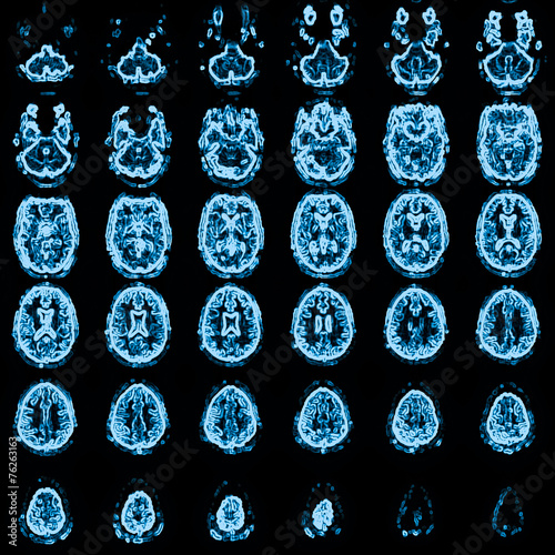 mri head magnetic resonance image photo