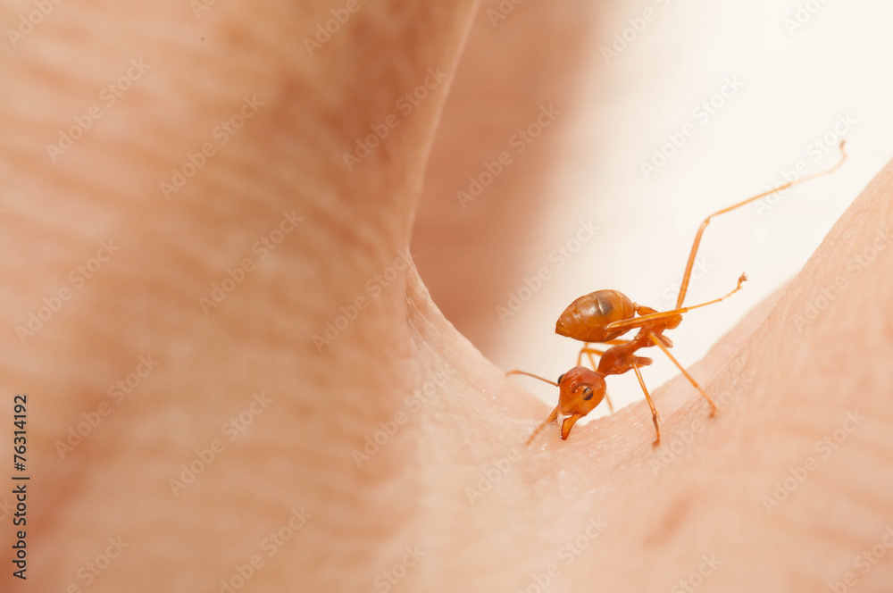 The angry ant attack to enemy by bite and spray citric acid The angry ant attack to enemy by bite and spray citric acid